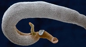 aké parazity môžu žiť v ľudskom žalúdku